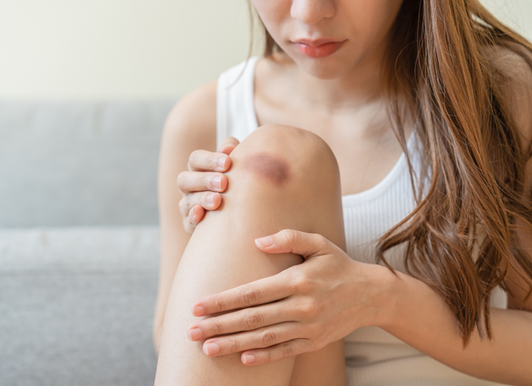 Adolescente con mano en la rodilla