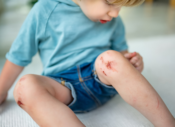 Niño con herida en la rodilla
