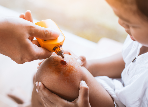 mano aplicando liquido en la rodilla del niño